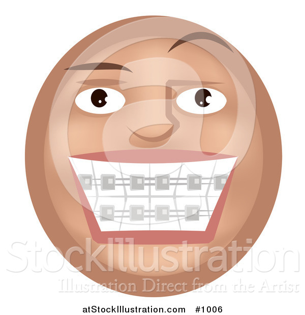 Vector Illustration of a Teeth Braces Emoticon - Tan Version