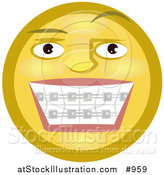 Illustration of an Emoticon Showing Braces on Teeth by AtStockIllustration