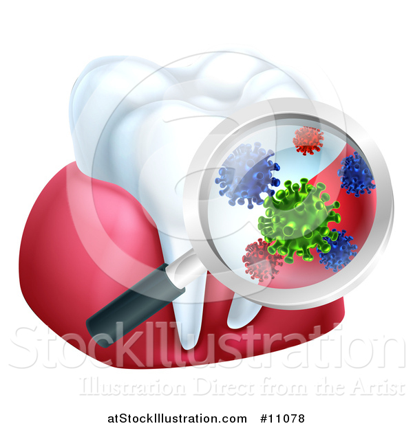 Vector Illustration of a 3d Magnifying Glass Discovering Germs or Bacteria on a Tooth and Gums