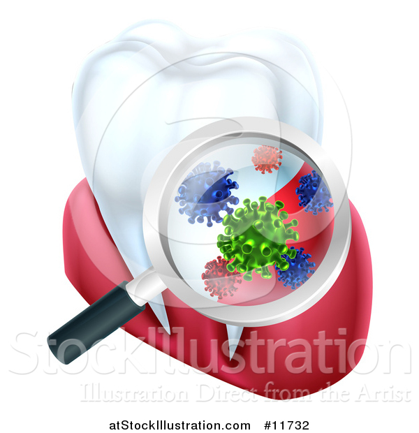 Vector Illustration of a 3d Magnifying Glass Discovering Germs or Bacteria on a Tooth and Gums