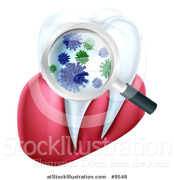 Vector Illustration of a 3d Magnifying Glass Discovering Germs or Bacteria on a Tooth and Gums