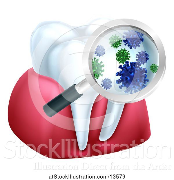 Vector Illustration of Magnifying Glass over a Tooth and Gums, Displaying Bacteria